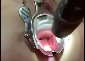 Vaginal speculum in someone's skin booty