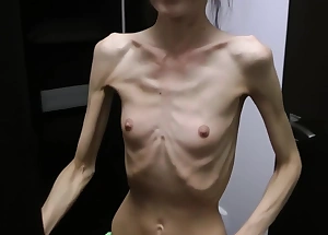 Anorexic Denisa posing and has ribs gripped
