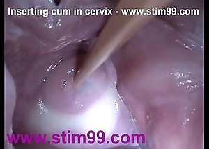 Flier sperm cum in cervix nigh dilatation cunt reflector